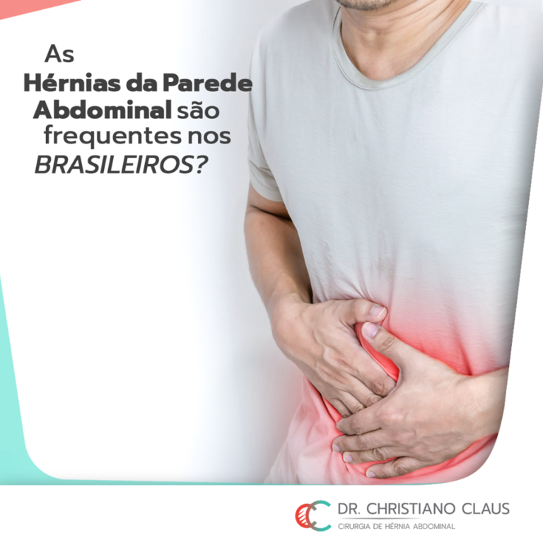 As hérnias da parede abdominal são frequentes nos brasileiros Dr