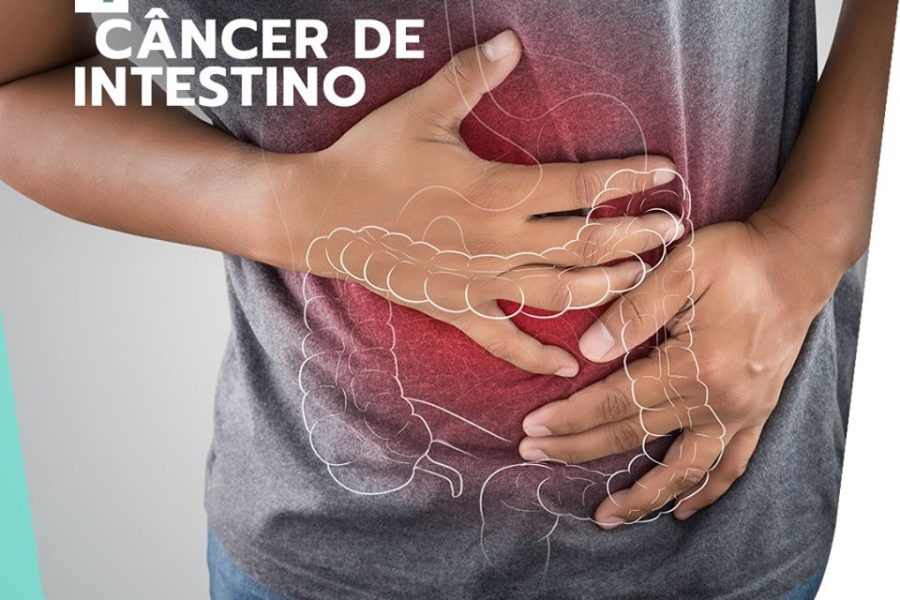 4 sintomas do câncer de intestino