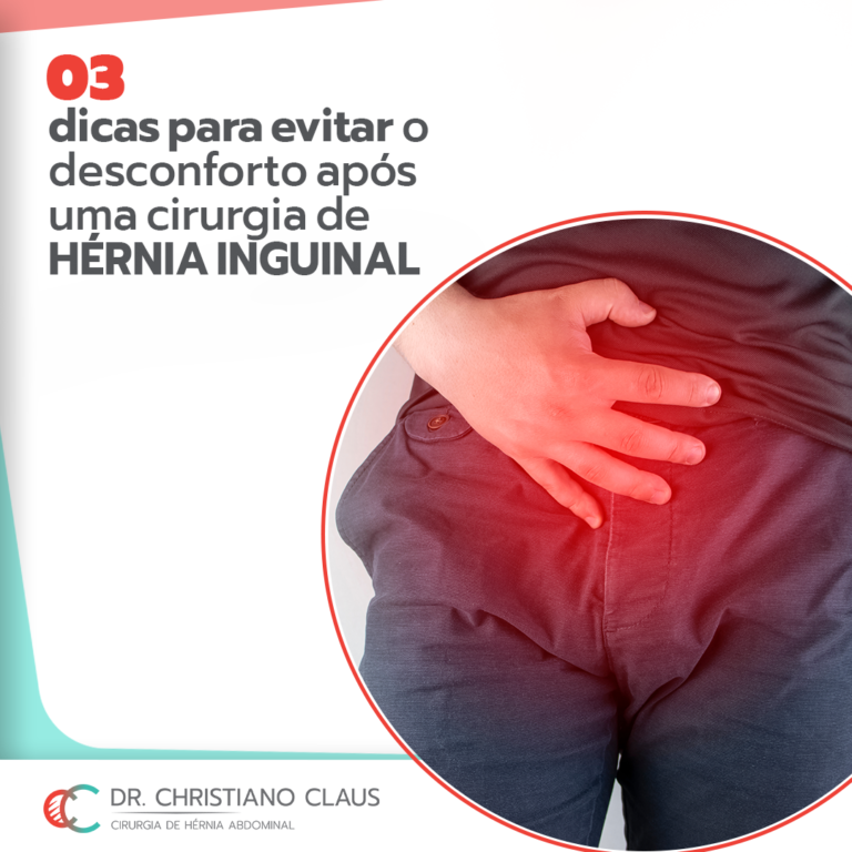 03 Dicas Para Evitar Desconforto Após A Sua Cirurgia De Hérnia Abdominal Dr Christiano Claus 