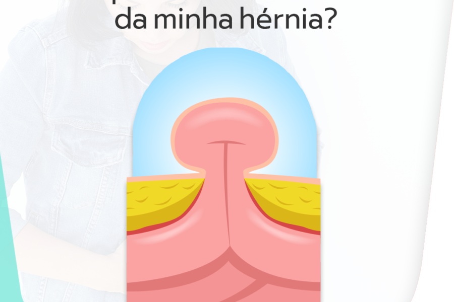 O que tem na ‘bolinha’ da minha hérnia?