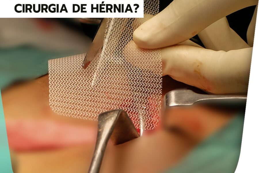 Qual é a função da tela em uma cirurgia de hérnia?