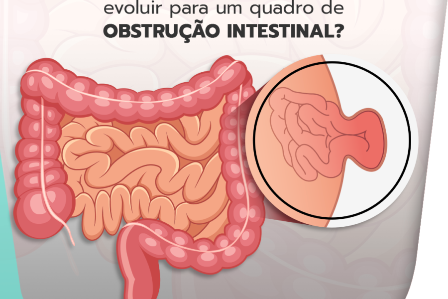 Quando as hérnias da parede abdominal podem evoluir para um quadro de obstrução intestinal?