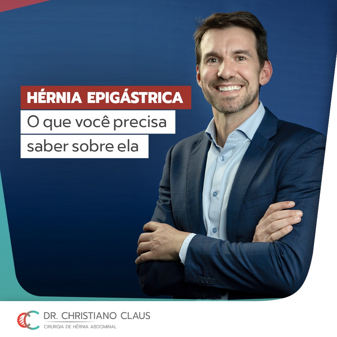 Cinco dicas para a recuperação da cirurgia de hérnia epigástrica - SBH