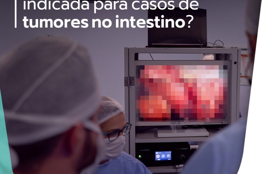 Por que a cirurgia é indicada para casos de tumores no intestino?