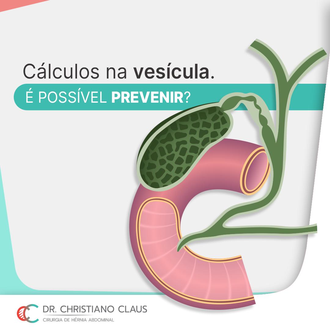 Seroma: o que é, sintomas, causas e tratamento - Tua Saúde