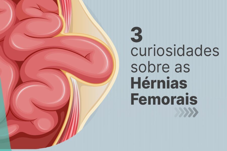 3 curiosidades sobre as hérnias femorais