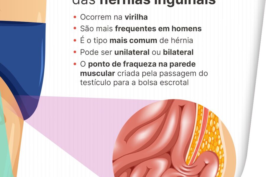Principais características das hérnias inguinais