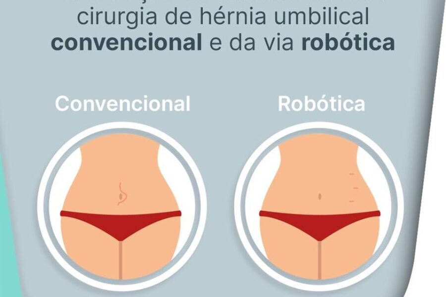 Diferenças na cicatriz de uma cirurgia de hérnia convencional e via robótica