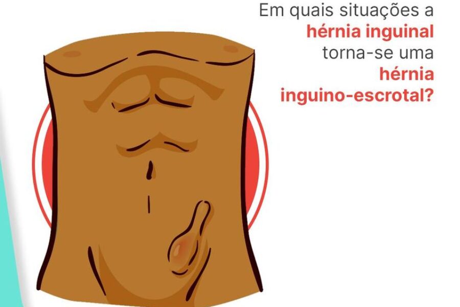 Em quais situações a hérnia inguinal se torna inguino escrotal?