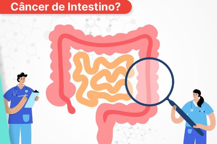 É possível prevenir o câncer de intestino?
