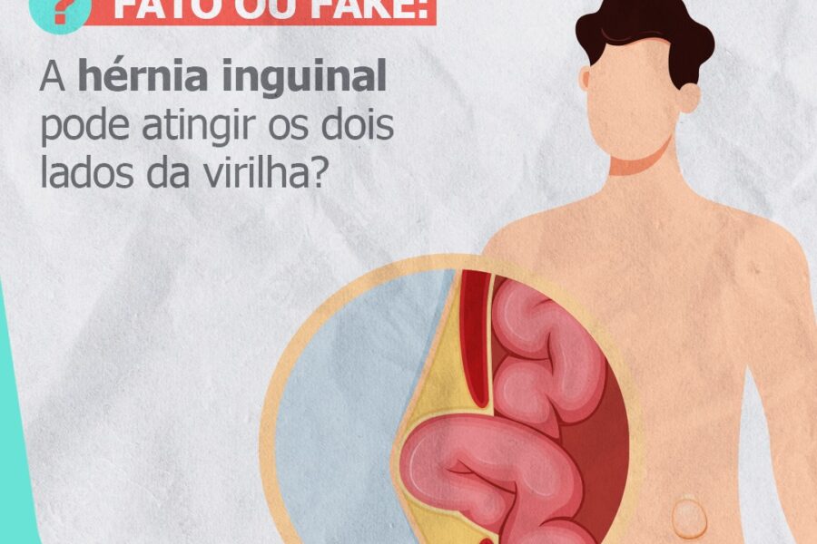 FATO OU FAKE | A hérnia inguinal pode atingir os dois lados da virilha?